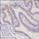 C22orf15 Recombinant Mouse Monoclonal Antibody (K9N021_14D4)