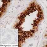 ART3 Recombinant Mouse Monoclonal Antibody (K8U020_3E8)