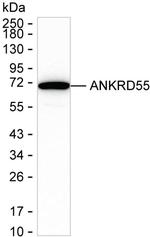 ANKRD55 Antibody in Western Blot (WB)