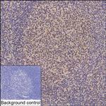 ZHX2 Recombinant Mouse Monoclonal Antibody (K94050_5A8)