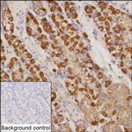 NDUFS4 Recombinant Mouse Monoclonal Antibody (K06372_10H6)