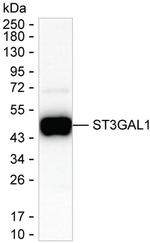 ST3GAL1 Recombinant Mouse Monoclonal Antibody (K94059_11C7)