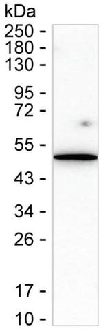 TEM7 Recombinant Mouse Monoclonal Antibody (K9N025_3D5)