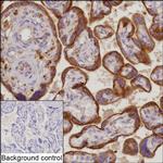 CLN2 Recombinant Mouse Monoclonal Antibody (K1H013_12G7)