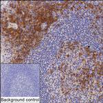 CRACC Recombinant Mouse Monoclonal Antibody (K8U029_14H8)