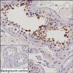 RNF115 Recombinant Mouse Monoclonal Antibody (K8U026_19C10)