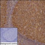 p53R2 Recombinant Mouse Monoclonal Antibody (K1H015_6B3)