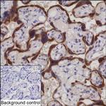 SUMF2 Recombinant Mouse Monoclonal Antibody (K94061_20B7)