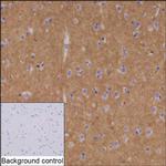 ADAM22 Antibody in Immunohistochemistry (Paraffin) (IHC (P))