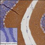 ADAM22 Recombinant Mouse Monoclonal Antibody (K40080_20C9)