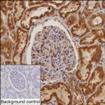 MCFD2 Recombinant Mouse Monoclonal Antibody (K40081_7D11)