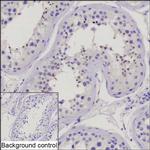 MMEL1 Recombinant Mouse Monoclonal Antibody (K8U030_18D9)