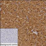 ASL Recombinant Mouse Monoclonal Antibody (KBL001_19F1)