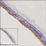 PDE6C Recombinant Mouse Monoclonal Antibody (K92073_15A1)