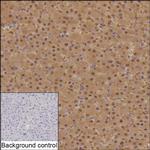 PSMB6 Recombinant Mouse Monoclonal Antibody (K9N035_2C9)