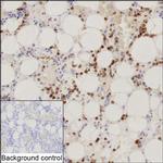 SERPINB1 Recombinant Mouse Monoclonal Antibody (K1H017_19G1)