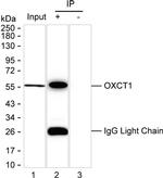 OXCT1 Recombinant Mouse Monoclonal Antibody (KBL001_10D10)
