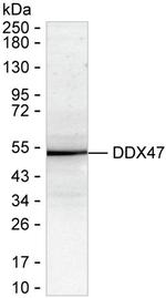DDX47 Recombinant Mouse Monoclonal Antibody (K8U031_16F5)