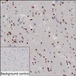 PITX3 Recombinant Mouse Monoclonal Antibody (K2K010_16F6)