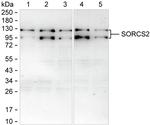 SorCS2 Recombinant Mouse Monoclonal Antibody (K1E068_6E10)