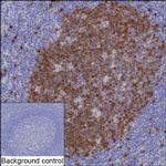 Thymidylate Synthase Antibody in Immunohistochemistry (Paraffin) (IHC (P))