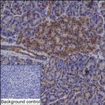 CRELD2 Recombinant Mouse Monoclonal Antibody (K1H020_9A8)