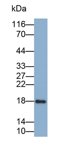 RNASE3 Antibody in Western Blot (WB)