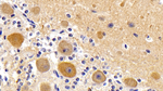 LC3A Monoclonal Antibody (C2)