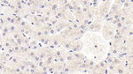 SIRT3 Antibody in Immunohistochemistry (Paraffin) (IHC (P))