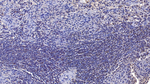 SIRT3 Antibody in Immunohistochemistry (Paraffin) (IHC (P))