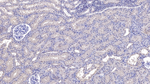 SIRT3 Antibody in Immunohistochemistry (Paraffin) (IHC (P))