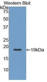 Angiopoietin 1 Antibody in Western Blot (WB)