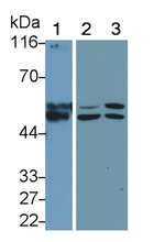 MMP11 Monoclonal Antibody (5#)