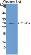 MMP11 Antibody in Western Blot (WB)
