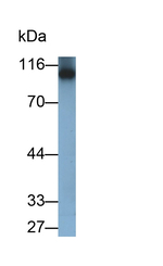 PYGL Antibody in Western Blot (WB)