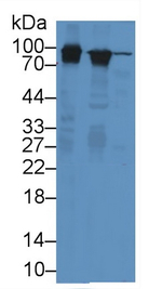 PYGL Antibody in Western Blot (WB)