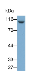 PYGL Antibody in Western Blot (WB)