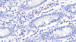 CTLA-4 Monoclonal Antibody (D4)