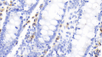 CTLA-4 Antibody in Immunohistochemistry (Paraffin) (IHC (P))