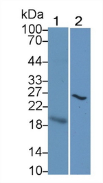 CTLA-4 Antibody in Western Blot (WB)