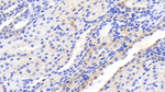 mTOR Antibody in Immunohistochemistry (Paraffin) (IHC (P))
