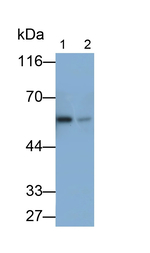Catalase Monoclonal Antibody (1#)