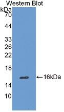 Catalase Antibody in Western Blot (WB)