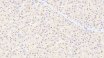 SERPINF2 Antibody in Immunohistochemistry (Paraffin) (IHC (P))