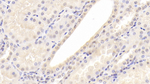 SERPINF2 Antibody in Immunohistochemistry (Paraffin) (IHC (P))