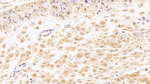 Tenascin C Antibody in Immunohistochemistry (Paraffin) (IHC (P))