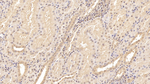 Tenascin C Antibody in Immunohistochemistry (Paraffin) (IHC (P))