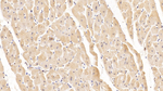 Tenascin C Antibody in Immunohistochemistry (Paraffin) (IHC (P))