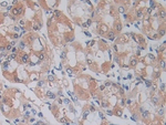 ADAM17 Antibody in Immunohistochemistry (Paraffin) (IHC (P))