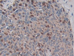 ADAM17 Antibody in Immunohistochemistry (Paraffin) (IHC (P))